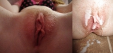 Teens before after