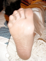 Suzanne\'s feet and toes