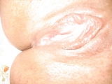 Turkaylin 1
