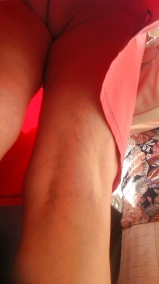 Spy upskirt 143 mature woman tanga ass romanian