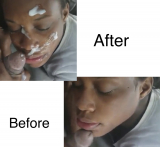 Facials
