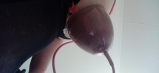 Extrem Vacuum pumped Titts and Nipples