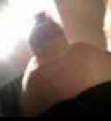 Extrem Vacuum pumped Titts and Nipples