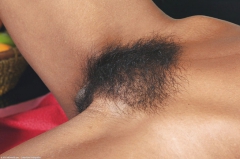 Mix hairy women 1 - N