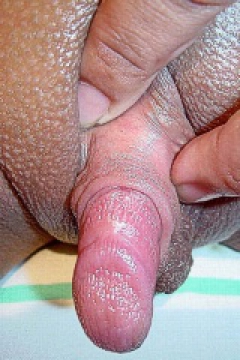Big clit - N