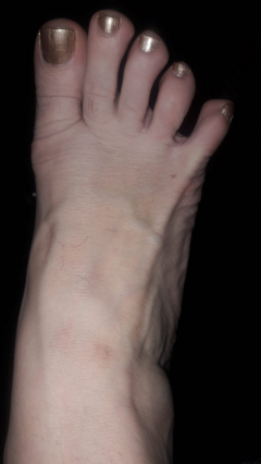 Feet fetish 2 - N