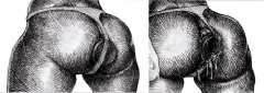 anal hole - N