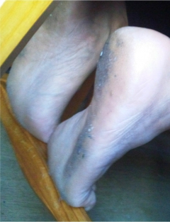 indian feet - N