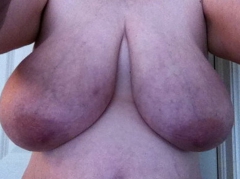 Busty Breast Reductions - Set 18 - N